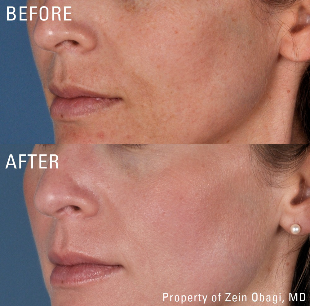 ZO Skin Care - Aging